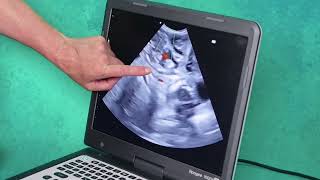 Cord insertion shown on canine pregnancy scan [upl. by Mcleroy]