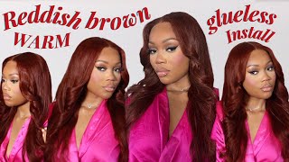 THE Easiest Glueless Wig Insall Pre Bleached Knots For Beginner Ft UNice Hair [upl. by Bethany256]