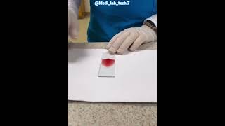 Blood smear is a technique healthcare providers use to microscope bloodculture labtechnologist [upl. by Mallorie]