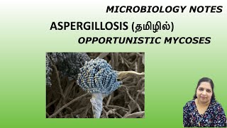 Aspergillosis  Opportunistic mycoses  Fungal infection  Dr Blessy  Tamil  Microbiology notes [upl. by Nylla]