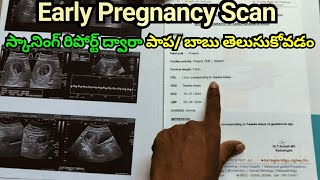 Early Pregnancy Scan  How To Read Pregnancy Scan Report  Pregnancy Scan  Pregnancy Journey [upl. by Yaakov]