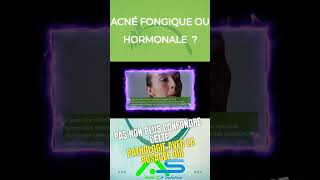 acne fongique ou hormonale [upl. by Urbanus]