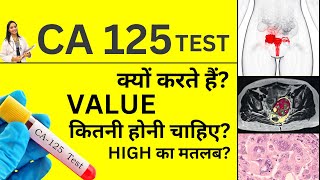 CA 125 Test क्या होता हैं क्यों करवाया जाता हैं  CA 125 Ovarian Cancer High Values amp Normal Range [upl. by Kath]