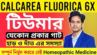 Calcarea Fluorica 6x  Calcarea Fluorica 12x Homeopathic Medicine  টিউমার হোমিওপ্যাথি চিকিৎসা [upl. by Mackenie]