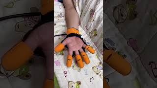 Finger Recovery Robot  best tool for fingers exercises 🔥 [upl. by Hort]