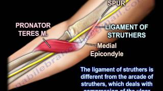 Pronator Teres Syndrome  Everything You Need To Know  Dr Nabil Ebraheim [upl. by Eegnat]