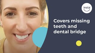 Covering Missing Teeth amp Dental Bridge  Instasmile Review [upl. by Ahsinal112]