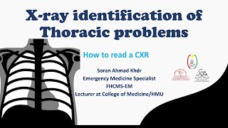 How to Read a Chest XRay [upl. by Odlo304]