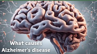 quotUnderstanding Alzheimer’s Causes Risks and Hope for a Cure [upl. by Wat]