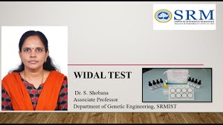 Widal test  Immunology Lab  DrSShobana  SRM Genetic Engineering  SRMGenetics [upl. by Nnylrebma585]