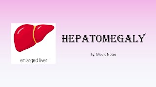 Hepatomegaly  causes pathophysiology [upl. by Eelahc236]