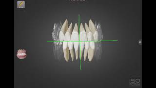 Basic concept of Tooth  Episod 01  Firoj Ahmed Fahim  MediVerse [upl. by Bevers]