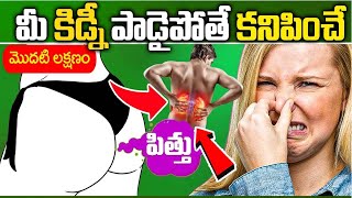 Kidney Disease Symptoms In Telugu  Kidney Disease  DrCL Venkat Rao  iD Health 360 [upl. by Ennairb]