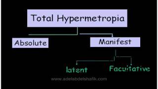 Errors of refraction for undergraduates  Hypermetropia [upl. by Hildy671]