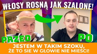 CUDA PO KTÓRYCH WŁOSY ROSNĄ JAK SZALONE❗️ [upl. by Serafine]