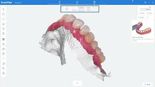 E5 Fussen IntraOral Scanner S6000 Options After Scanning [upl. by Haroun]