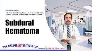 Subdural Hematoma  Causes Diagnosis Symptoms Treatment Prognosis [upl. by Revkah]