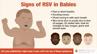 Signs amp Symptoms of RSV in Babies  AAP [upl. by Einitsed926]