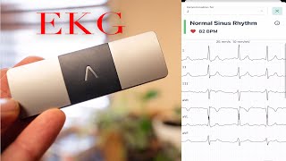 EKG at Home  KardiaMobile 6Lead Personal EKG Monitor [upl. by Nisse]