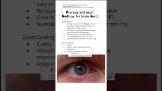 Prereqs and exam findings for brain death [upl. by Navert]