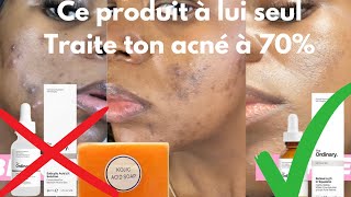 Imperfections du visage ce produit moins cher à lui seul traite l’acné et tâches à 70 [upl. by Girish]