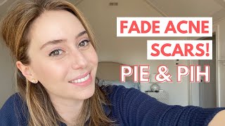 How To Fade Acne Scars Post Inflammatory Erythema amp Post Inflammatory Hyperpigmentation [upl. by Leynwad]