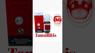 Tonsillitis treatment Dr Mehwish Akhter Homeopathic healthcare alternativemedicine anatomy [upl. by Elburt301]