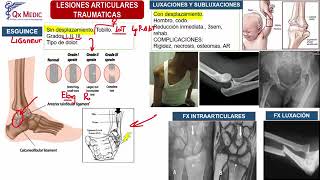 Fracturas Lesiones de Partes Blandas  Ortopedia y Traumatología Clases Qx Medic  04 [upl. by Onitnas]