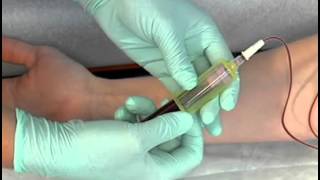 Sample Procedure  Venipuncture Butterfly Method [upl. by Abernon]