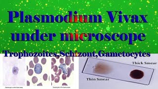 Plasmodium Vivax under microscope TrophozoitesSchizontGametocytesclear explain [upl. by Feodore]