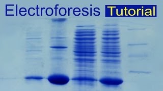 Electroforesis de proteínas tutorial Divulgación científica IQOGCSIC [upl. by Gladdy]