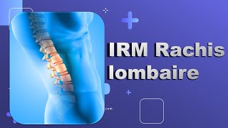 IRM du Rachis lombaire Bonne Pratique [upl. by Alyks430]