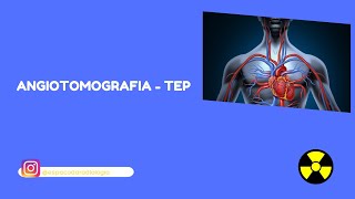 ANGIOTOMOGRAFIA Angiotomografia para diagnóstico de TEP  Trombo embolia pulmonar [upl. by Nodnalb211]