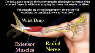 Radial Nerve Palsy injury  WRIST DROP  Everything You Need To Know  Dr Nabil Ebraheim [upl. by Ramunni]