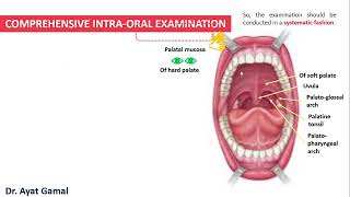 Intraoral exam Part 4 Palatal mucosa [upl. by Sierra194]