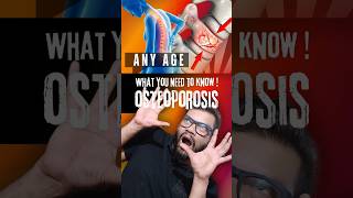 STOP Ignoring These Osteoporosis Warning Signs fitnessmotivation motivation [upl. by Wittenburg557]