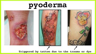 pyoderma [upl. by Ainelec]