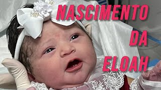 NASCIMENTO DA ELOAH [upl. by Alta388]