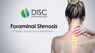 Pinched Nerve in Neck or Back Foraminal Stenosis Causes Symptoms Treatments [upl. by Georges]