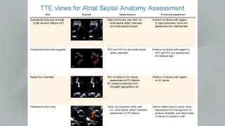 Guidelines for the Echocardiographic Assessment of Atrial Septal Defect amp Patent Foramen Ovale [upl. by Woodford]