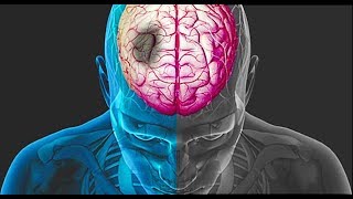 Understanding the Brain Stroke  Brain Anatomy Anatomy of the Human Brain [upl. by Leinahtan]