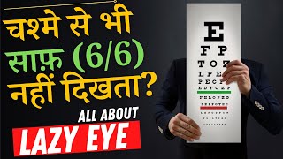 What is A LAZY EYE Amblyopia and How to Fix it  Amblyopia Lazy Eye Causes amp Treatment in Hindi [upl. by Acinorrev757]