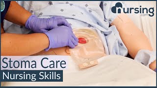 Stoma Care Changing a Colostomy Bag Nursing Skills [upl. by Atiuqehc993]