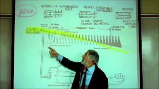 CARDIAC PHYSIOLOGY PART 4 by Professor Finkwmv [upl. by Micky]