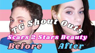 Transgender Shout Outs 0017 🏳️‍⚧️ Scars 2 Stars Beauty HRT Male To Female Transition Timeline [upl. by Ross]