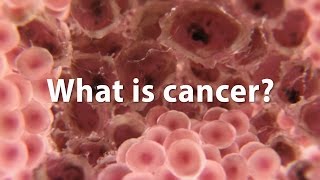 What is cancer What causes cancer and how is it treated UPDATE [upl. by Etnaik]