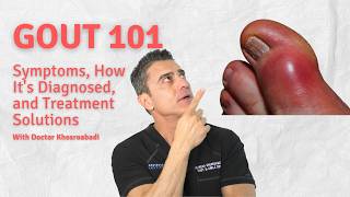 Gout 101 Symptoms How Its Diagnosed and Treatment Solutions [upl. by Onaicram553]