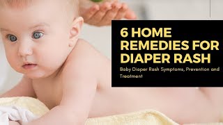 6 home remedies for diaper rash in Babies Baby Diaper Rash Symptoms Prevention and Treatment [upl. by Musa]