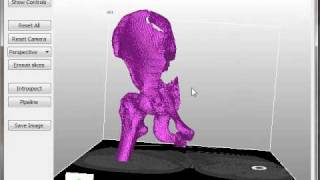 Extracting STL surface from CT data with DeVIDE [upl. by Hans]