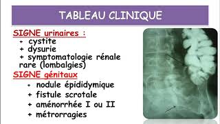 Cours Pathologie Médicale PARTIE 2 [upl. by Veta]